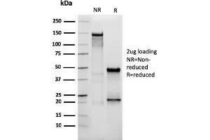 SDS-PAGE Analysis Purified Vimentin Mouse Monoclonal Antibody (VIM/3736).