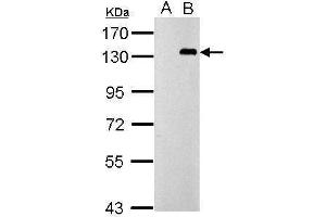 WB Image Sample (30 ug of whole cell lysate) A: Non-transfected 293T lysates B: TLR9 transfected 293T lysates 7.