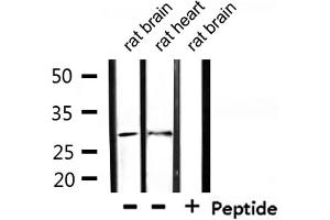 Western blot analysis of extracts from rat brain, rat heart, using TNFRSF9 Antibody.