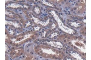 Detection of MTX1 in Human Kidney Tissue using Polyclonal Antibody to Metaxin 1 (MTX1)