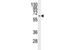 MAPK15 antibody western blot analysis in MCF-7 lysate.