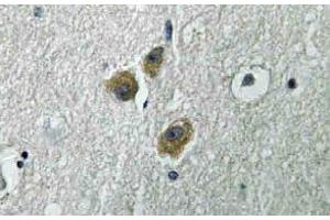 Immunohistochemistry (IHC) analyzes of ME3 antibody in paraffin-embedded human brain tissue. (ME3 anticorps)