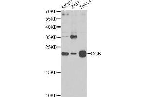 Western blot analysis of extracts of various cell lines, using CGB Antibody. (Chorionic Gonadotropin, beta Polypeptide 3 (CGB3) anticorps)
