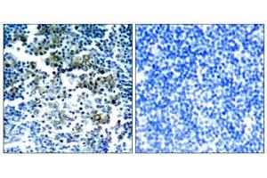 Immunohistochemical analysis of paraffin-embedded human tonsil tumor tissue, using Bcr (phospho-Tyr177) antibody (E011199). (BCR anticorps  (pTyr177))