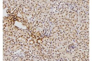 ABIN6276386 at 1/100 staining Mouse kidney tissue by IHC-P.