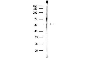 Western blot analysis of lysates from Rat testis, using Phospho-IRF-7 (Ser437/Ser438) Antibody at 1/1000 dilution.