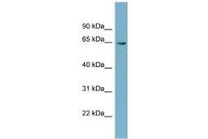 Image no. 1 for anti-Phosphoglucomutase 3 (PGM3) (AA 107-156) antibody (ABIN6741932) (Phosphoglucomutase 3 anticorps  (AA 107-156))