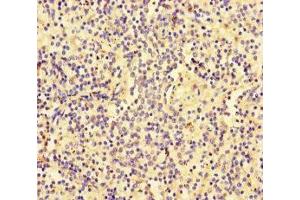 Immunohistochemistry of paraffin-embedded human spleen tissue using ABIN7176672 at dilution of 1:100