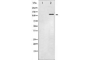 Western blot analysis of JAK2 phosphorylation expression in K562 whole cell lysates,The lane on the left is treated with the antigen-specific peptide.