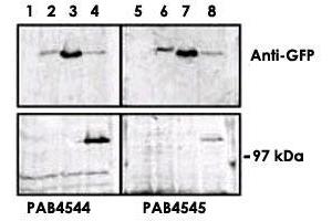 Upper panel, western blot analysis of GFP fusion protein expression in Panc-1 cells by using an PRKD3 polyclonal antibody  . (PRKD3 anticorps  (C-Term))