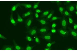 Immunofluorescence analysis of A549 cells using APTX Polyclonal Antibody (Aprataxin anticorps)