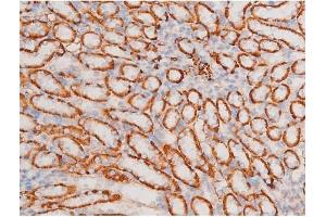 ABIN6267577 at 1/200 staining Mouse kidney tissue sections by IHC-P.