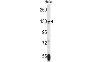 TNKS Antibody (N-term) western blot analysis in Hela cell line lysates (35 µg/lane). (TNKS anticorps  (N-Term))