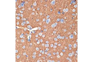 Immunohistochemistry of paraffin-embedded mouse brain using Syntaxin Rabbit mAb (ABIN7270685) at dilution of 1:100 (40x lens).