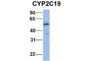 Host:  Rabbit  Target Name:  NOP56  Sample Type:  Human Fetal Muscle  Antibody Dilution:  1.