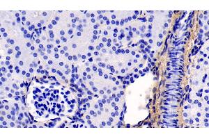 Detection of COL1a1 in Human Kidney Tissue using Monoclonal Antibody to Collagen Type I Alpha 1 (COL1a1) (COL1A1 anticorps  (AA 253-471))