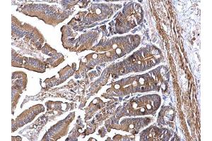 IHC-P Image RRM2 antibody [N1C1] detects RRM2 protein at cytoplasm on mouse intestine by immunohistochemical analysis. (RRM2 anticorps  (Regulatory Subunit))