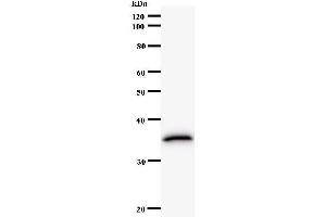 Western Blotting (WB) image for anti-Translin-Associated Factor X (TSNAX) antibody (ABIN932466) (TSNAX anticorps)