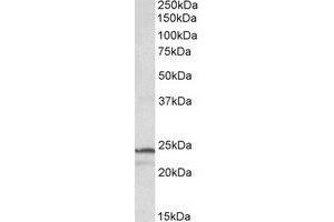 Western Blotting (WB) image for anti-Proteasome Subunit beta 3 (PSMB3) (Internal Region) antibody (ABIN2464725) (PSMB3 anticorps  (Internal Region))