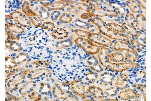 ABIN6262943 and ABIN6277882 at 1/100 staining Rat kidney tissue by IHC-P. (LDLR anticorps  (Internal Region))