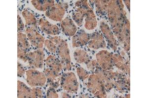 Used in DAB staining on fromalin fixed paraffin- embedded stomach tissue (MYH10 anticorps  (AA 438-716))