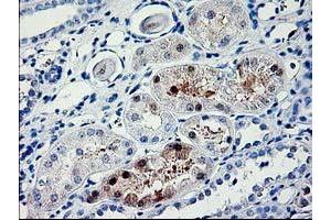 Immunohistochemical staining of paraffin-embedded Human Kidney tissue using anti-PDE6G mouse monoclonal antibody.