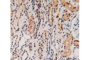 IHC-P analysis of kidney tissue, with DAB staining. (KRT16 anticorps  (AA 117-419))