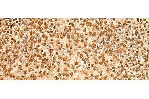 Immunohistochemistry of paraffin-embedded Human tonsil tissue using HIST1H2BA Polyclonal Antibody at dilution of 1:45(x200) (HIST1H2BA anticorps)