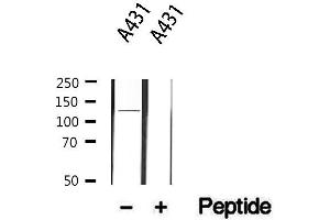 Western blot analysis of extracts from A431, using ITGA6 Antibody. (ITGA6 anticorps  (N-Term))