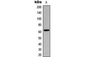 Western blot analysis of CHK2 (pT383) expression in HeLa (A) whole cell lysates. (CHEK2 anticorps  (pSer383))