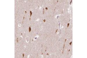 Immunohistochemical staining (Formalin-fixed paraffin-embedded sections) of human hippocampus with SCG3 polyclonal antibody  shows cytoplasmic positivity in neurons. (SCG3 anticorps)