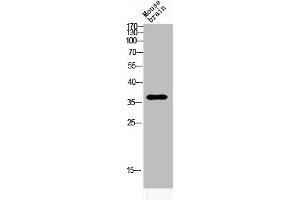 Western blot analysis of MOUSE-BRAIN lysis using ART1 antibody.