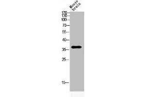 Western blot analysis of MOUSE-BRAIN lysis using ART1 antibody. (ART1 anticorps  (Internal Region))