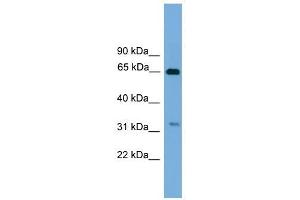UBXD3 antibody used at 1 ug/ml to detect target protein. (UBXN10 anticorps  (Middle Region))
