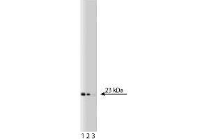Western blot analysis of Bid on a Jurkat cell lysate (Human T-cell leukemia, ATCC TIB-152). (BID anticorps  (AA 50-62))