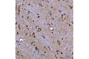IHC analysis of Nedd4 using anti-Nedd4 antibody (ABIN7602341).