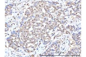 IHC analysis of RANBP2 using anti-RANBP2 antibody (ABIN7602650). (RANBP2 anticorps  (AA 906-2744))