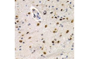 Immunohistochemistry of paraffin-embedded rat brain using ID3 antibody (ABIN5973111) at dilution of 1/200 (40x lens). (ID3 anticorps)