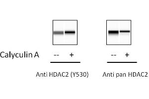 HeLa cells were treated or untreated with Calyculin A. (HDAC2 Kit ELISA)
