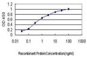 Detection limit for recombinant GST tagged ROCK1 is approximately 0. (ROCK1 anticorps  (AA 401-510))