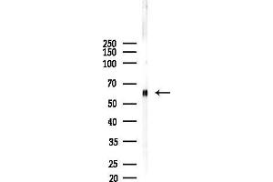 anti-Caspase 10, Apoptosis-Related Cysteine Peptidase (CASP10) antibody