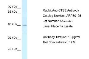 Western Blotting (WB) image for anti-Cathepsin E (CTSE) (C-Term) antibody (ABIN2788343) (Cathepsin E anticorps  (C-Term))