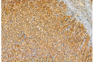 ABIN6263284 and ABIN6272925 at 1/100 staining Rat stomach tissue by IHC-P. (MLYCD anticorps  (Internal Region))