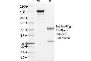 SDS-PAGE Analysis Purified ARF1 Mouse Monoclonal Antibody (1A9/5). (ARF1 anticorps  (C-Term))