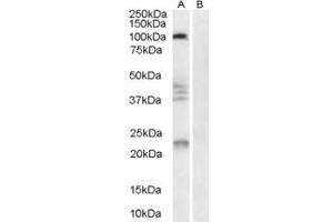 Western Blotting (WB) image for anti-ATPase, H+ Transporting V0 Subunit E2 (ATP6V0E2) (N-Term) antibody (ABIN2156417) (ATP6V0E2 anticorps  (N-Term))