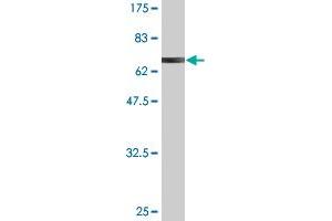 Western Blot detection against Immunogen (67. (AIPL1 anticorps  (AA 1-384))