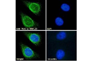 ABIN185241 Immunofluorescence analysis of paraformaldehyde fixed HeLa cells, permeabilized with 0. (RNF125 anticorps  (C-Term))