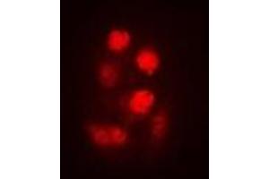 Immunofluorescent analysis of SEN2 staining in A549 cells. (TSEN2 anticorps)