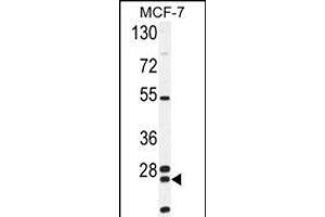 NUDT8 Antibody (N-term) (ABIN654517 and ABIN2844241) western blot analysis in MCF-7 cell line lysates (35 μg/lane). (NUDT8 anticorps  (N-Term))