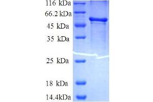 Ferritin, Heavy Polypeptide 1 (FTH1) (AA 2-183), (full length) protein (GST tag) (FTH1 Protein (AA 2-183, full length) (GST tag))